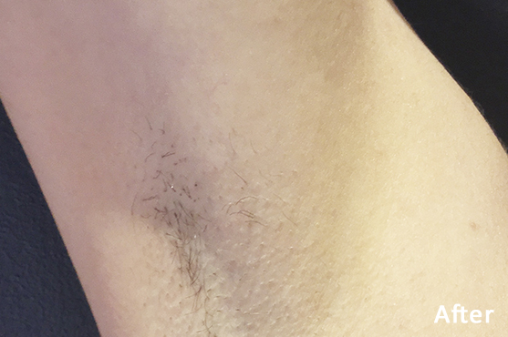 After