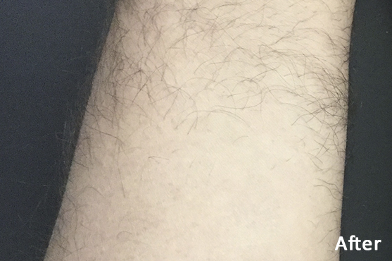 After