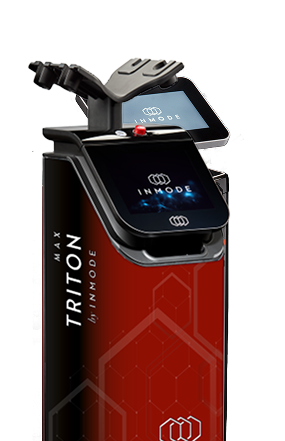 TritonMAX
